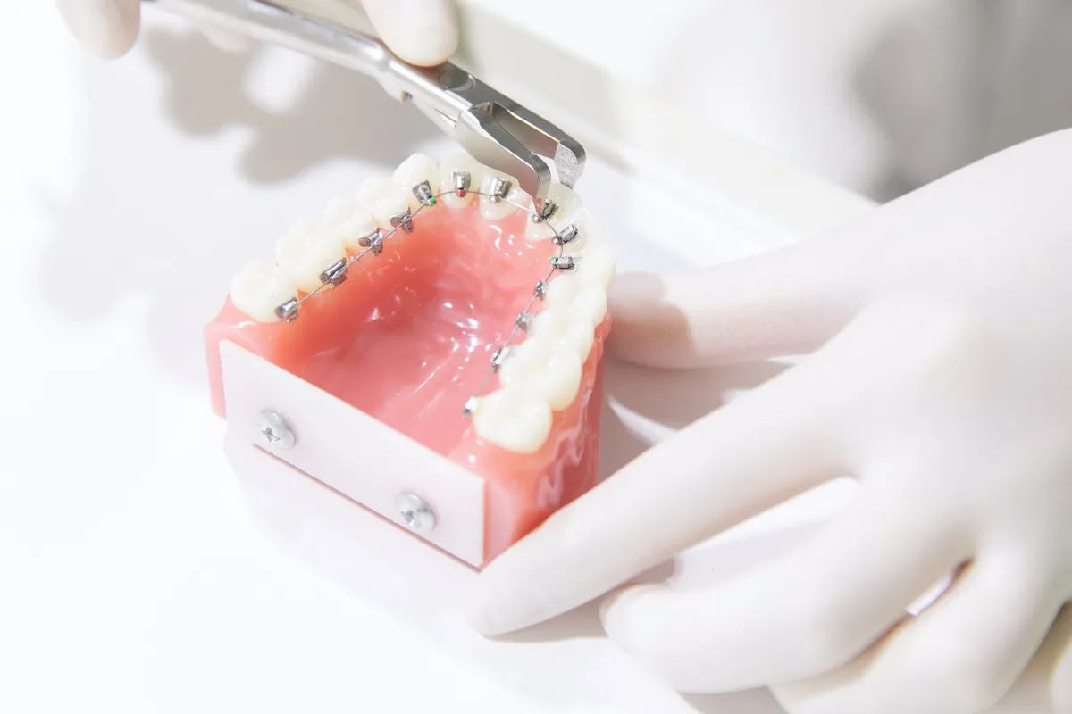 目立ちにくい舌側（裏側）矯正を専門に取り扱う歯科医院のイメージ